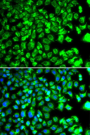C10orf32 Antibody