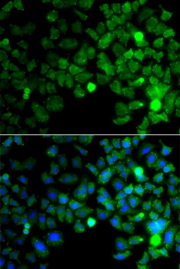 Polyclonal Rabbit anti-Human SMIF / DCP1A Antibody (IHC, IF, WB)