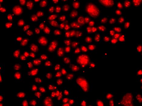 Polyclonal Rabbit anti-Human FANCM Antibody (IF, WB)
