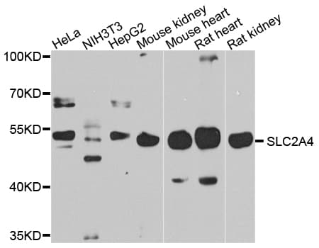 Polyclonal Rabbit anti-Human SLC2A4 / GLUT-4 Antibody (IHC, WB)