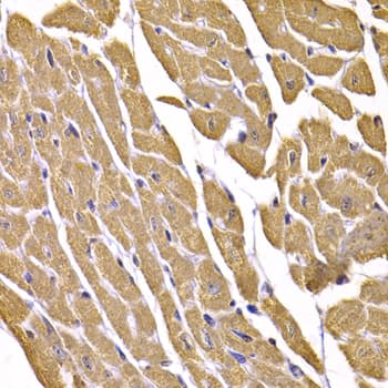 Polyclonal Rabbit anti-Human SLC2A4 / GLUT-4 Antibody (IHC, WB)