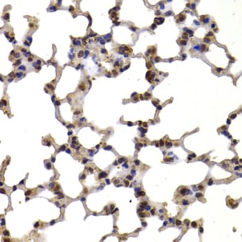 Polyclonal Rabbit anti-Human TXN / Thioredoxin / TRX Antibody (IHC, WB)