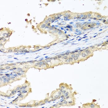 Polyclonal Rabbit anti-Human CP / Ceruloplasmin Antibody (IHC, WB)