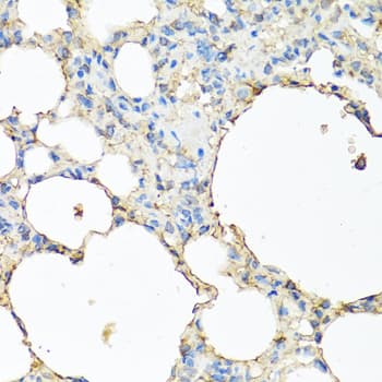 Polyclonal Rabbit anti-Human CP / Ceruloplasmin Antibody (IHC, WB)
