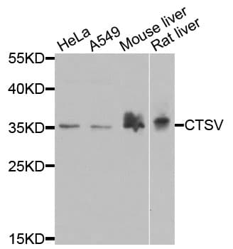 Polyclonal Rabbit anti-Human CTSV / Cathepsin V Antibody (IHC, WB)