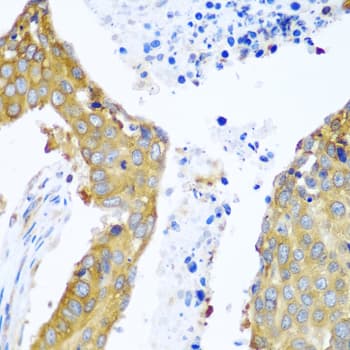 Polyclonal Rabbit anti-Human YBX1 / YB1 Antibody (IHC, WB)