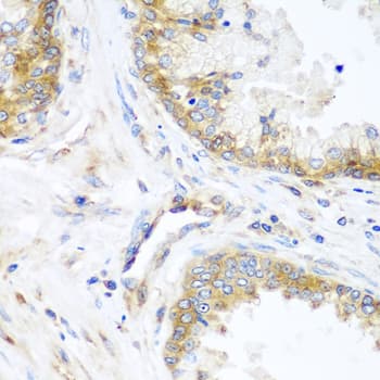 Polyclonal Rabbit anti-Human YBX1 / YB1 Antibody (IHC, WB)