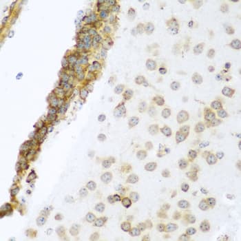 Polyclonal Rabbit anti-Human YBX1 / YB1 Antibody (IHC, WB)