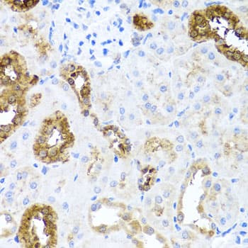 Polyclonal Rabbit anti-Human SHH / Sonic Hedgehog Antibody (IHC, WB)