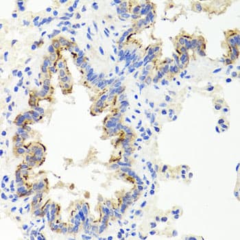 Polyclonal Rabbit anti-Human SHH / Sonic Hedgehog Antibody (IHC, WB)