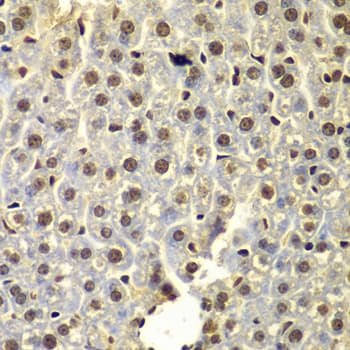 SSX5 Antibody