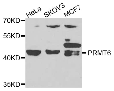 Polyclonal Rabbit anti-Human PRMT6 Antibody (IHC, WB)