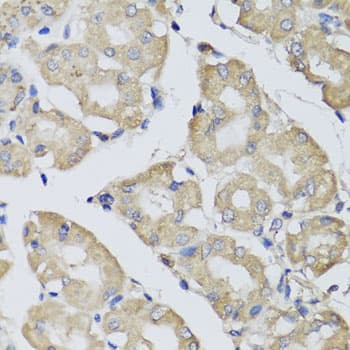 Polyclonal Rabbit anti-Human BPGM Antibody (IHC, WB)