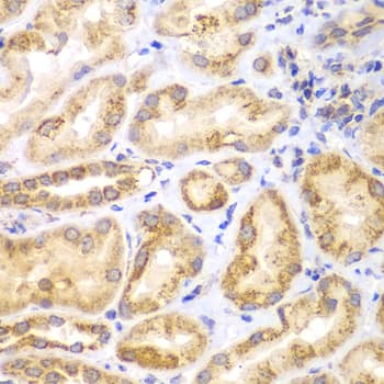 EYA3 Antibody