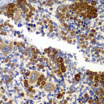 Polyclonal Rabbit anti-Human PRKAB1 / AMPK Beta 1 Antibody (IHC, WB)