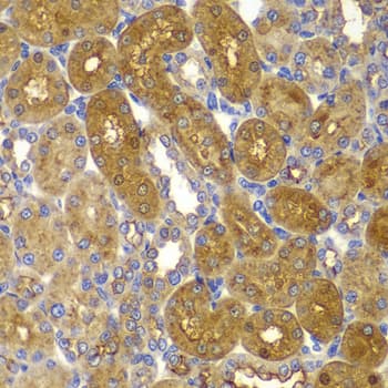 Polyclonal Rabbit anti-Human PRKAB1 / AMPK Beta 1 Antibody (IHC, WB)