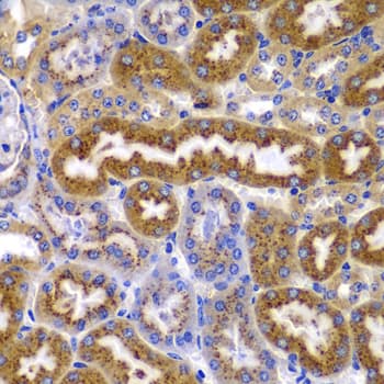 Polyclonal Rabbit anti-Human PRKAB1 / AMPK Beta 1 Antibody (IHC, WB)