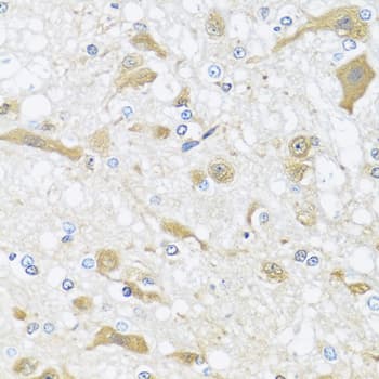 Polyclonal Rabbit anti-Human APOL1 / Apolipoprotein L Antibody (AP, IHC, WB)