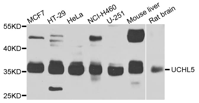 Polyclonal Rabbit anti-Human UCHL5 / UCH37 Antibody (IHC, IF, WB)