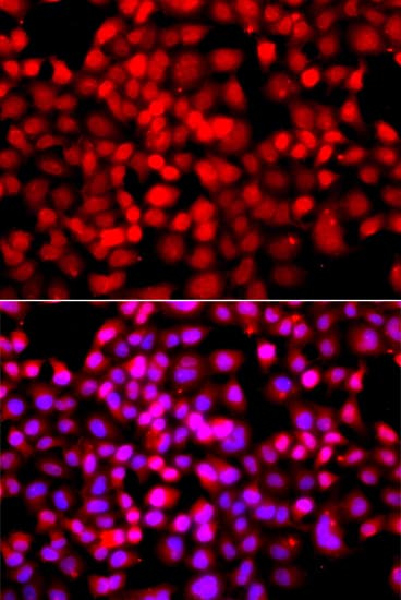 Polyclonal Rabbit anti-Human TDP1 Antibody (IHC, IF, WB)