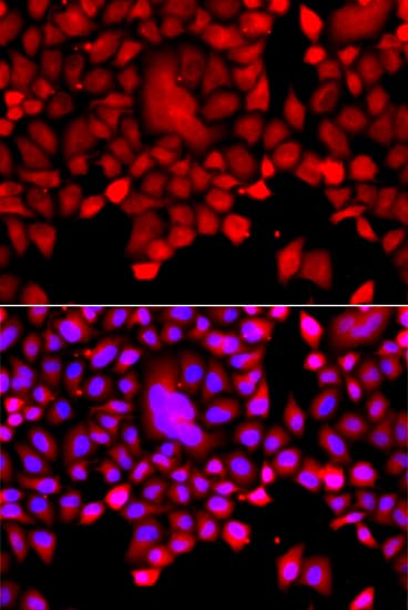Polyclonal Rabbit anti-Human TDP1 Antibody (IHC, IF, WB)