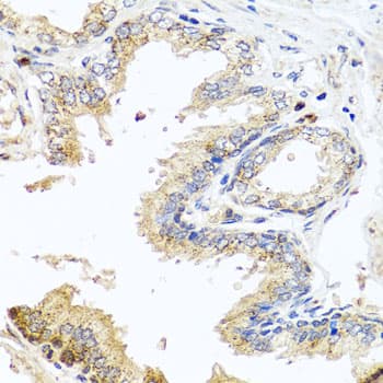 Polyclonal Rabbit anti-Human MCCC2 / MCCB Antibody (IHC, WB)