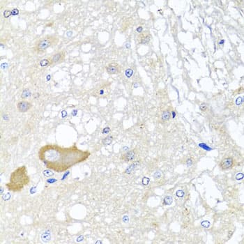 Polyclonal Rabbit anti-Human MCCC2 / MCCB Antibody (IHC, WB)
