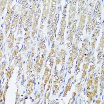 Polyclonal Rabbit anti-Human MCCC2 / MCCB Antibody (IHC, WB)