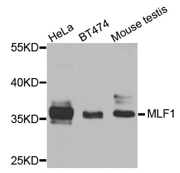 Polyclonal Rabbit anti-Human MLF1 Antibody (IF, WB)