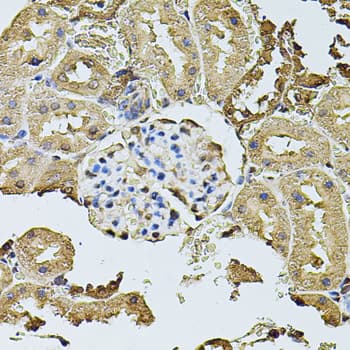 Polyclonal Rabbit anti-Human CDH6 / K Cadherin Antibody (IHC, WB)