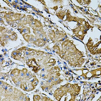 Polyclonal Rabbit anti-Human CDH6 / K Cadherin Antibody (IHC, WB)