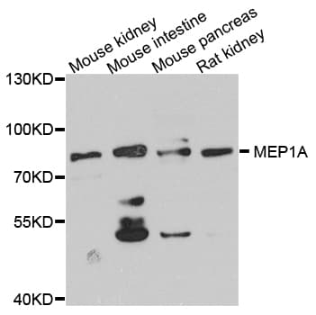 Polyclonal Rabbit anti-Human MEP1A / Meprin Alpha Antibody (WB)