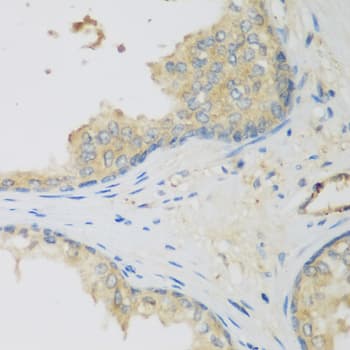 LLGL2 Antibody