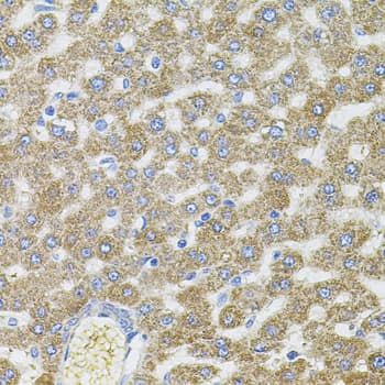 CEP164 Antibody