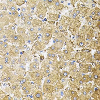 CEP164 Antibody