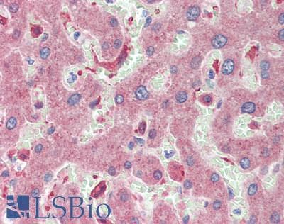 IHC-plus™ Polyclonal Rabbit anti-Human CLEC4E / MINCLE Antibody (IHC, IF)