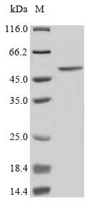 Human ST6GAL1 / CD75 Protein (Recombinant 6His, N-terminus)