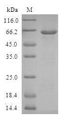 Human AKR1C4 / Chlordecone Reductase Protein (Recombinant GST, N-terminus)