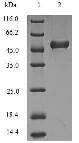 Human BRCC3 / BRCC36 Protein (Recombinant GST-6His, N-terminus)