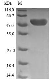 Human TPK1 Protein (Recombinant GST, N-terminus)