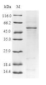 Human GAS41 Protein (Recombinant GST, N-terminus)