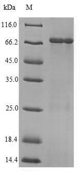 Influenza A Virus Nucleocapsid Protein (Recombinant 6His-SUMO, N-terminus)