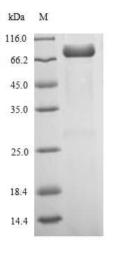 Influenza A Virus Nucleocapsid Protein (Recombinant 6His-SUMO, N-terminus)