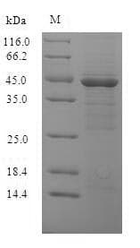 Vibrio parahaemolyticus ompK Protein (Recombinant 6His-SUMO, N-terminus)
