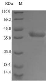 Staphylococcus aureus LDHA / LDH1 Protein (Recombinant 6His-SUMO, N-terminus)