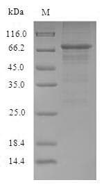 Influenza A Virus Nucleocapsid Protein (Recombinant 6His-B2M, N-terminus)