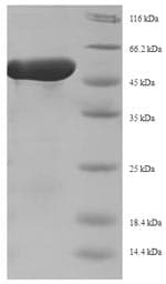 Staphylococcus aureus repD Protein (Recombinant 6His-SUMO, N-terminus)