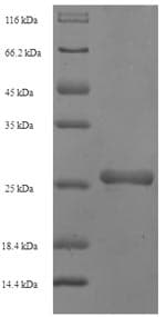 Staphylococcus aureus scn Protein (Recombinant 6His-SUMO, N-terminus)