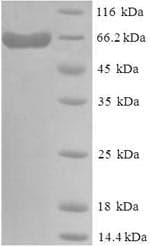 Human Delta3 / DLL3 Protein (Recombinant 6His-SUMO, N-terminus)