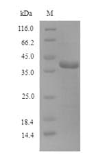 Human OGG1 Protein (Recombinant 6His, N-terminus)